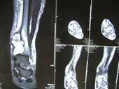 coimbatore-orthopaedic-joint-replacement-maternity-child-welfare-centre-india